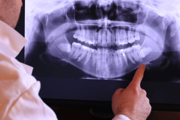 Best Emergency Treatment for Jaw Pain or Injury in Garner, NC